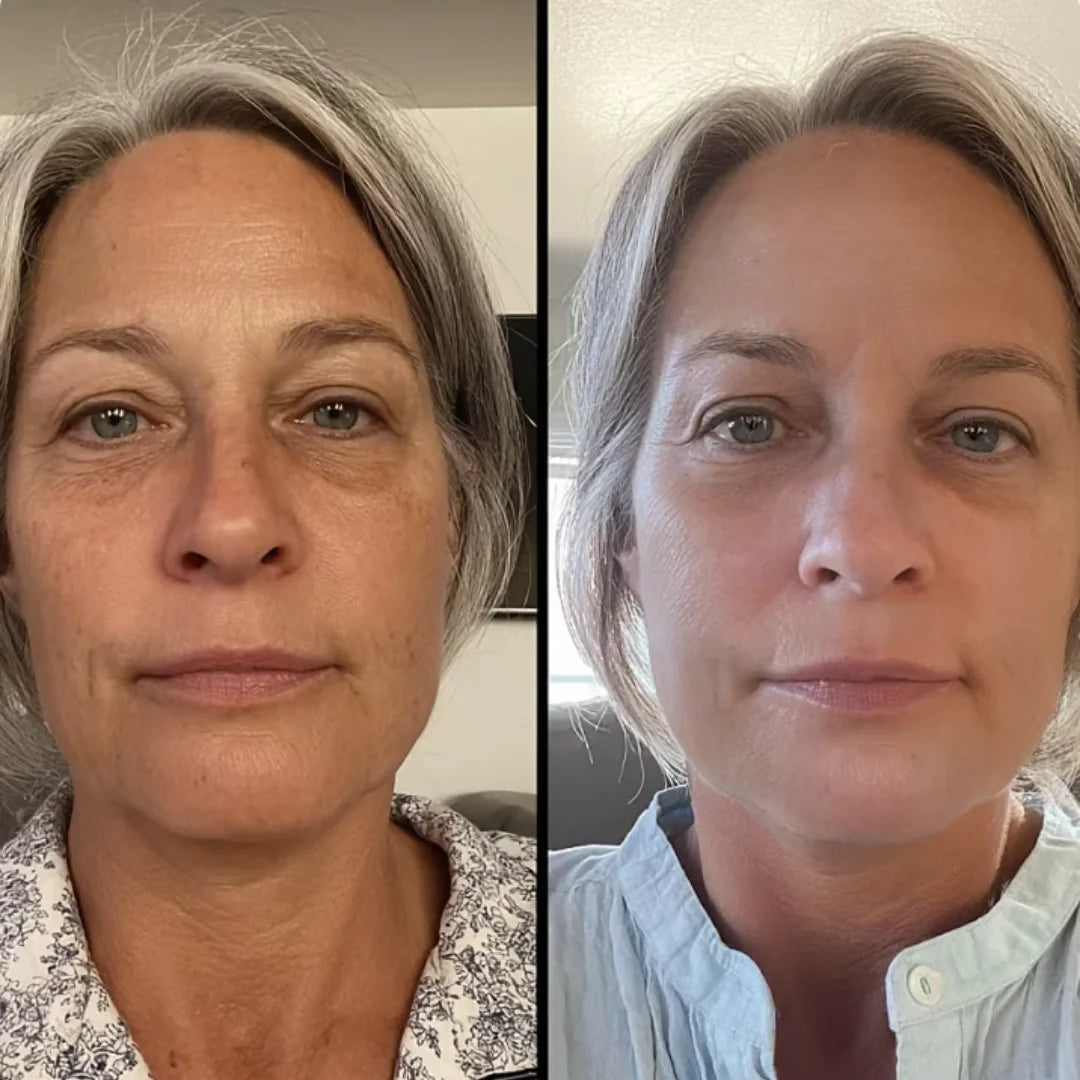 Antes e depois 3